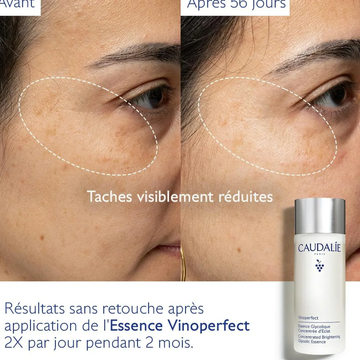 CAUDALIE Éclat, Anti-Taches|Formats Voyage^Essence Glycolique Concentrée d'Éclat