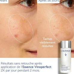 CAUDALIE Éclat, Anti-Taches|Formats Voyage^Essence Glycolique Concentrée d'Éclat