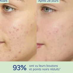 CAUDALIE Peaux À Tendance Acnéique|Crèmes & Fluides^Fluide Matifiant Hydratant à la Poudre de Silice