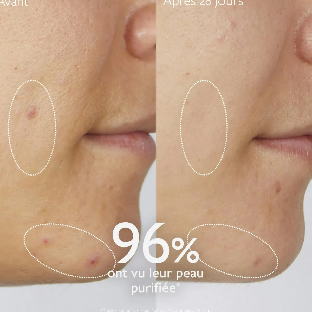 CAUDALIE Peaux À Tendance Acnéique|Démaquillants & Nettoyants^Gelée Nettoyante à l'Acide Salicylique Purifiante - 75mL