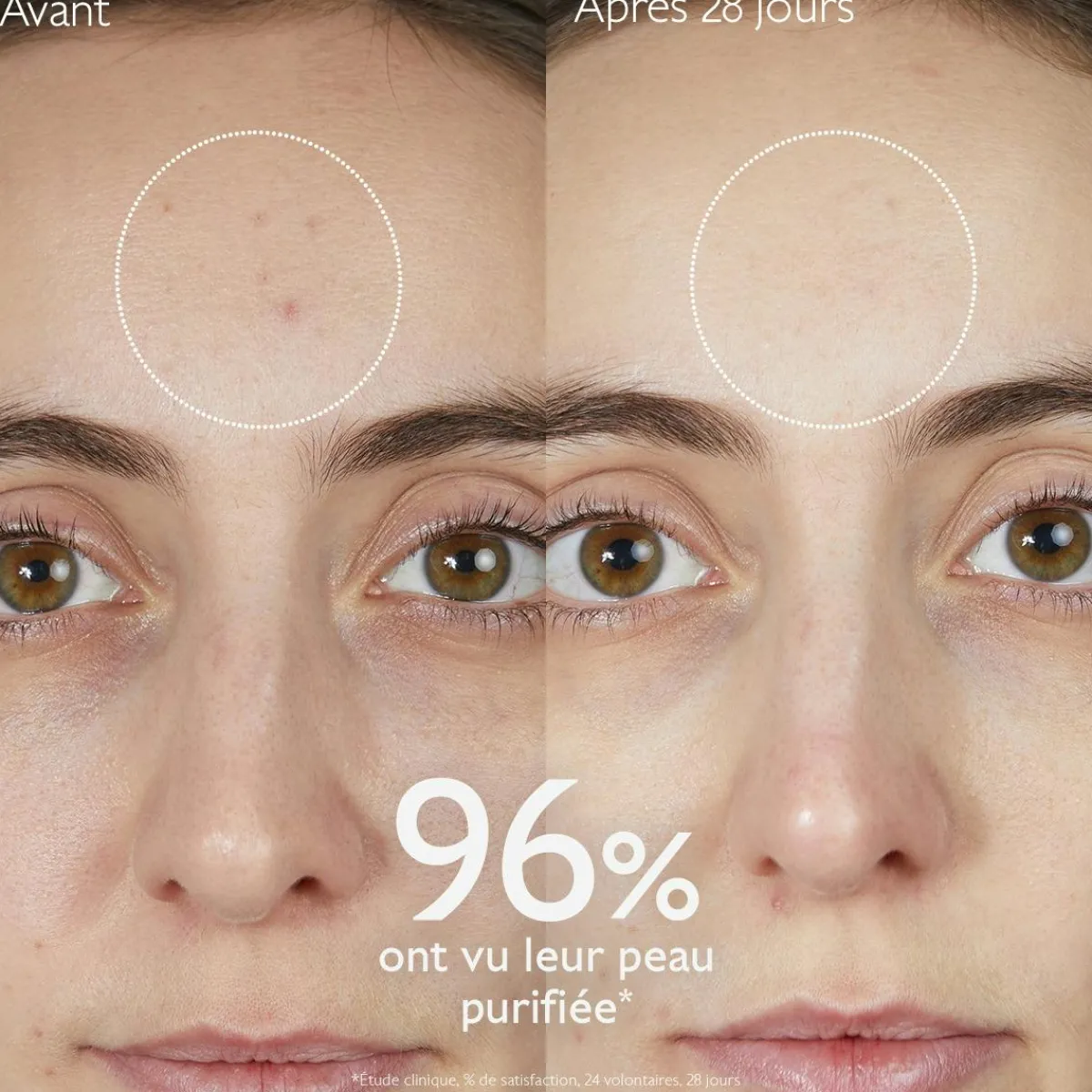 CAUDALIE Peaux À Tendance Acnéique|Démaquillants & Nettoyants^Gelée Nettoyante à l'Acide Salicylique Purifiante - 150mL