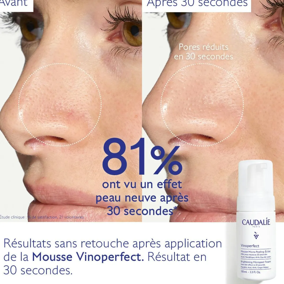 CAUDALIE Éclat, Anti-Taches|Formats Voyage^Mousse Micro-Peeling Éclat à l'Acide Mandélique (AHA) - 50mL
