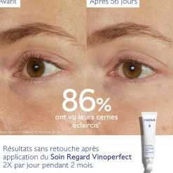 CAUDALIE Anti-Cernes, Poches|Éclat, Anti-Taches^Soin Éclaircissant Regard Anti-Cernes à la Caféine et Niacinamide