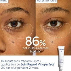 CAUDALIE Anti-Cernes, Poches|Éclat, Anti-Taches^Soin Éclaircissant Regard Anti-Cernes à la Caféine et Niacinamide