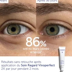 CAUDALIE Anti-Cernes, Poches|Éclat, Anti-Taches^Soin Éclaircissant Regard Anti-Cernes à la Caféine et Niacinamide
