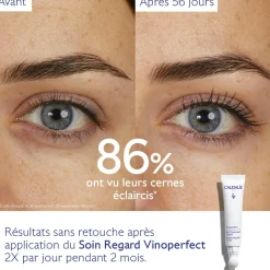 CAUDALIE Anti-Cernes, Poches|Éclat, Anti-Taches^Soin Éclaircissant Regard Anti-Cernes à la Caféine et Niacinamide