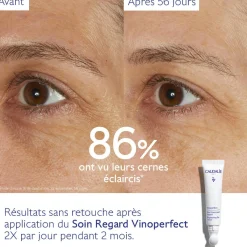 CAUDALIE Anti-Cernes, Poches|Éclat, Anti-Taches^Soin Éclaircissant Regard Anti-Cernes à la Caféine et Niacinamide