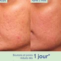 CAUDALIE Peaux À Tendance Acnéique|Sérums^Sérum à l'Acide Salicylique Anti-imperfections
