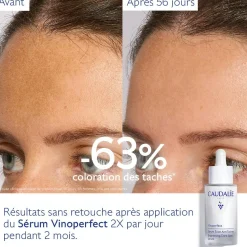 CAUDALIE Sérums|Éclat, Anti-Taches^Sérum Éclat Anti-Taches à la Viniférine, alternative à la Vitamine C - 30ml