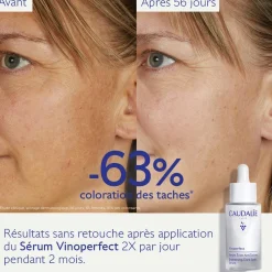 CAUDALIE Sérums|Éclat, Anti-Taches^Sérum Éclat Anti-Taches à la Viniférine, alternative à la Vitamine C - 30ml