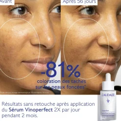 CAUDALIE Sérums|Éclat, Anti-Taches^Sérum Éclat Anti-Taches à la Viniférine, alternative à la Vitamine C - 30ml