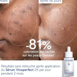 CAUDALIE Sérums|Éclat, Anti-Taches^Sérum Éclat Anti-Taches à la Viniférine, alternative à la Vitamine C - 30ml