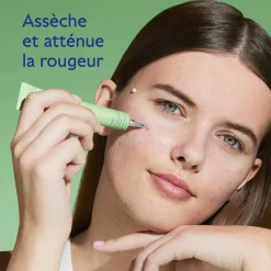 CAUDALIE Peaux À Tendance Acnéique|Crèmes & Fluides^Stop Boutons Salicylique l'Acide Salicylique
